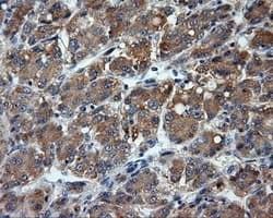 LIPG / Endothelial Lipase Antibody (clone OTI3C7)