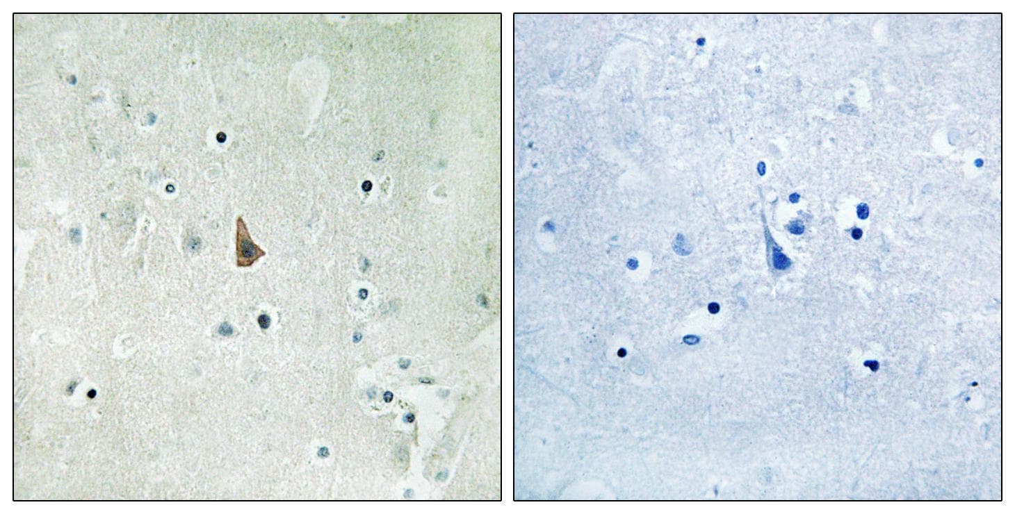 Polyclonal Rabbit anti-Human NTRK3 / TRKC Antibody (phospho-Tyr516, IHC, WB)