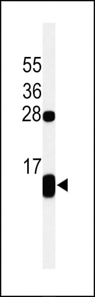 Polyclonal Rabbit anti-Human PLN / Phospholamban Antibody (aa1-30, IHC, WB)