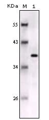 PathPlus™ S100B / S100 Beta Antibody (clone 9A11B9)