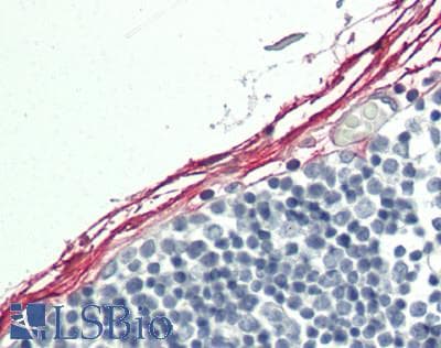 IHC-plus™ IHH Antibody