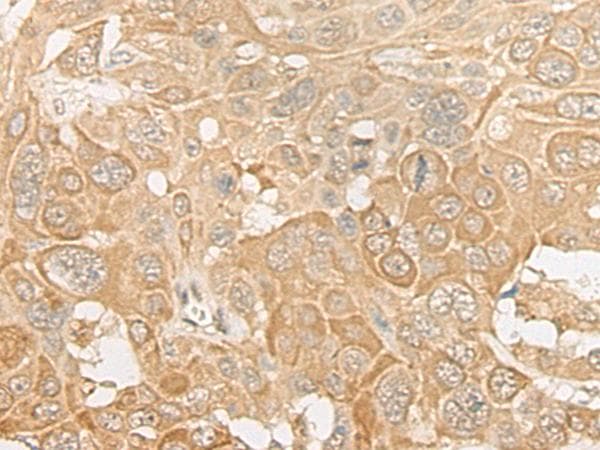 Polyclonal Rabbit anti-Human ROM1 Antibody (IHC, WB)