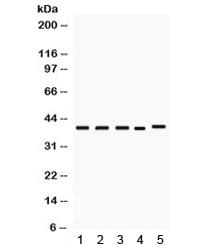 DMRT1 Antibody