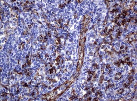 PECAM-1 / CD31 Antibody (clone UMAB30)