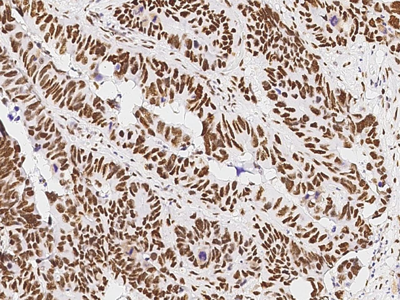 PSME3 Antibody (Preservative Free)