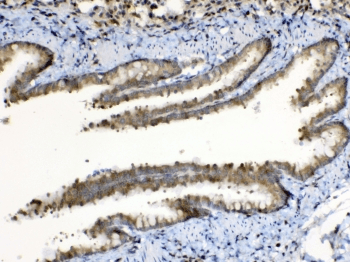 PPL / Periplakin Antibody