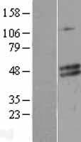 CECR5 Protein (Over-Expression Lysate Myc-DDK (Flag))