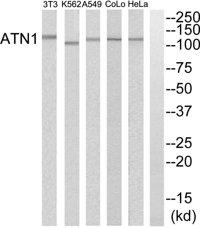 Polyclonal Rabbit anti-Human DRPLA / Atrophin-1 Antibody (WB)
