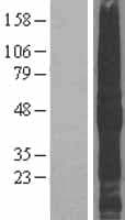 TMEFF2 Protein (Over-Expression Lysate Myc-DDK (Flag))