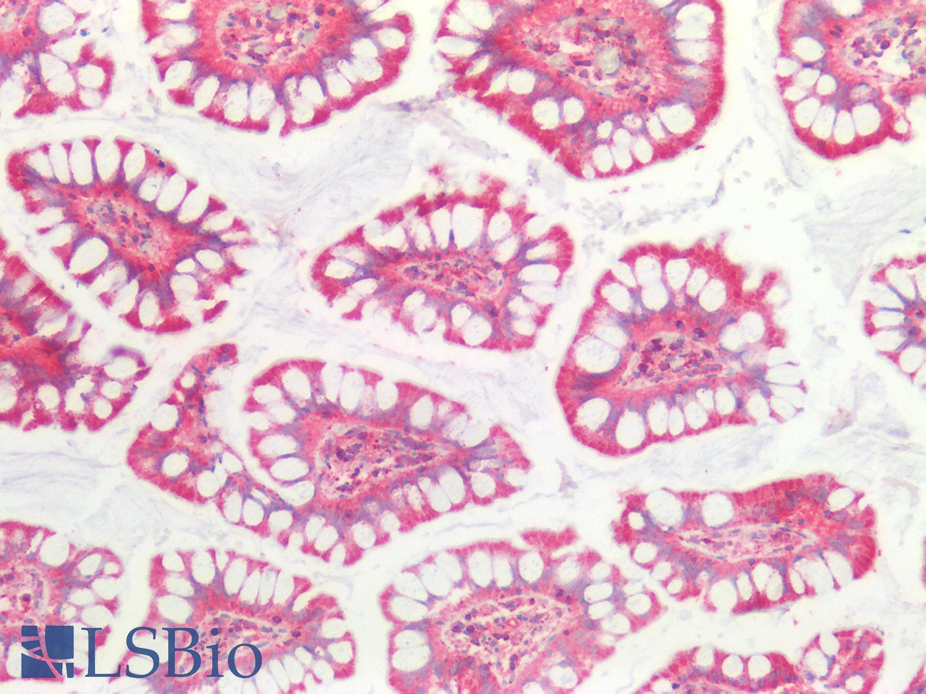 PathPlus™ SSBP1 / mtSSB Antibody