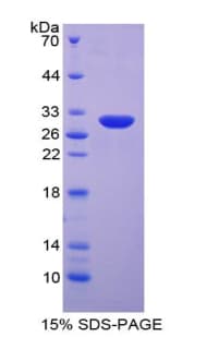 Human CCS Protein (Recombinant His-T7)