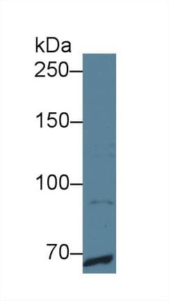 MER / MERTK Antibody (aa587-858)