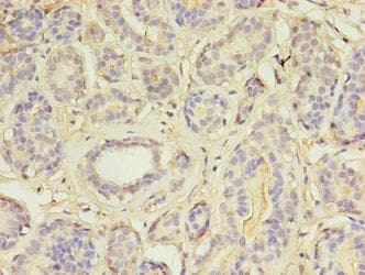 MAP3K7CL / TAK1L Antibody (aa1-142)