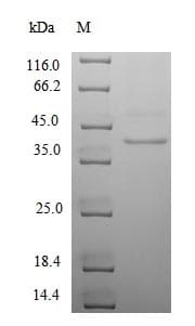 Human UL130 Protein (Recombinant 6His-SUMO, N-terminus)