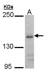 Polyclonal Rabbit anti-Human GRIN2B / NMDAR2B / NR2B Antibody (WB)