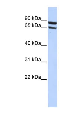 SLC6A15 / SBAT1 Antibody (aa180-229)