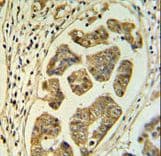 HCCS Antibody (aa173-200)