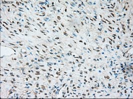 TRPM4 Antibody (clone OTI10H5)