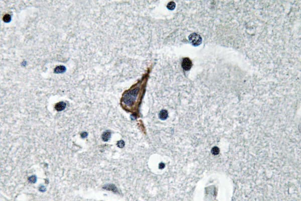 TLR4 Antibody (aa392-441)