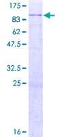 Human PHACTR1 Protein (Recombinant GST)