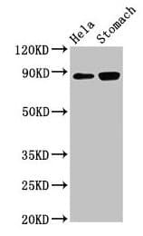 Polyclonal Rabbit anti-Human ASAH2 Antibody