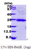 Human RHOC Protein (Recombinant His)