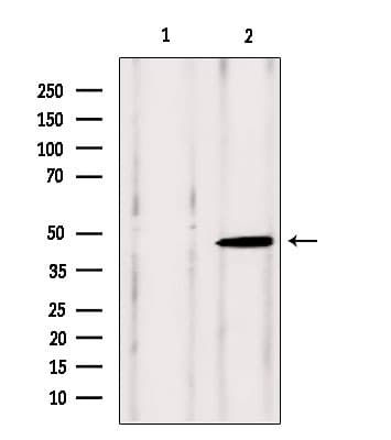 Polyclonal Rabbit anti-Human VPS37A Antibody (IHC, IF, WB)