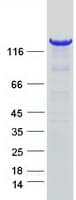Human AOX1 / Aldehyde Oxidase Protein (Recombinant Myc-DDK (Flag))