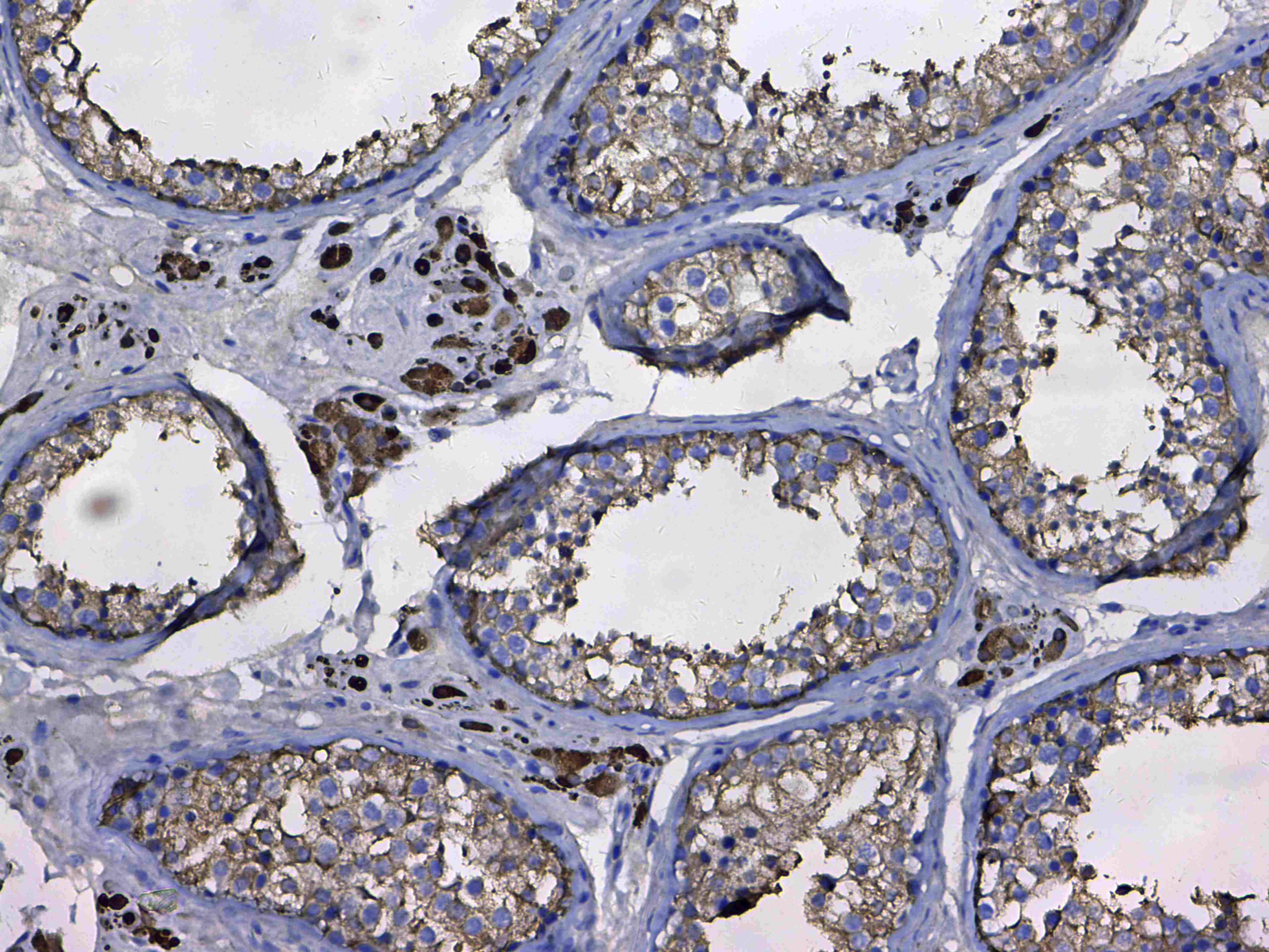 GSTM3 Antibody