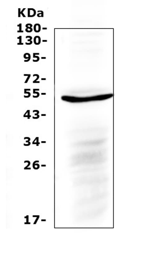 IL6R / IL6 Receptor Antibody (aa379-419)