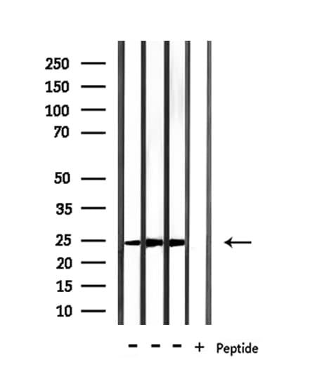 RAB15 Antibody