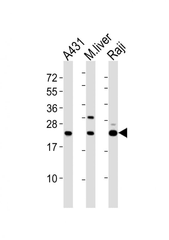 PSMB9 Antibody (aa205-239)