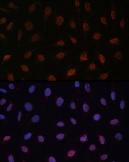 MED25 Antibody