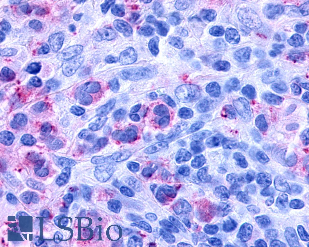 IHC-plus™ CYSLTR1 / CYSLT1 Antibody (Extracellular Domain)
