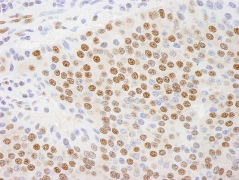 CTBP1 / CTBP Antibody (aa400-440)