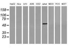 Monoclonal Mouse anti-Human CORO1A / Coronin 1a Antibody (clone OTI1A5, IF, WB)