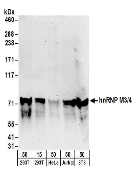 HNRPM / HNRNPM Antibody (aa475-525)