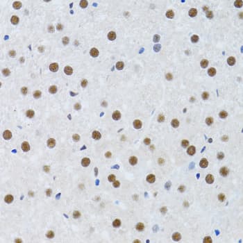 MTA3 Antibody