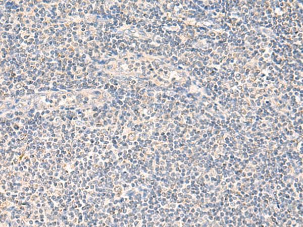 NEGR1 / Neurotractin Antibody