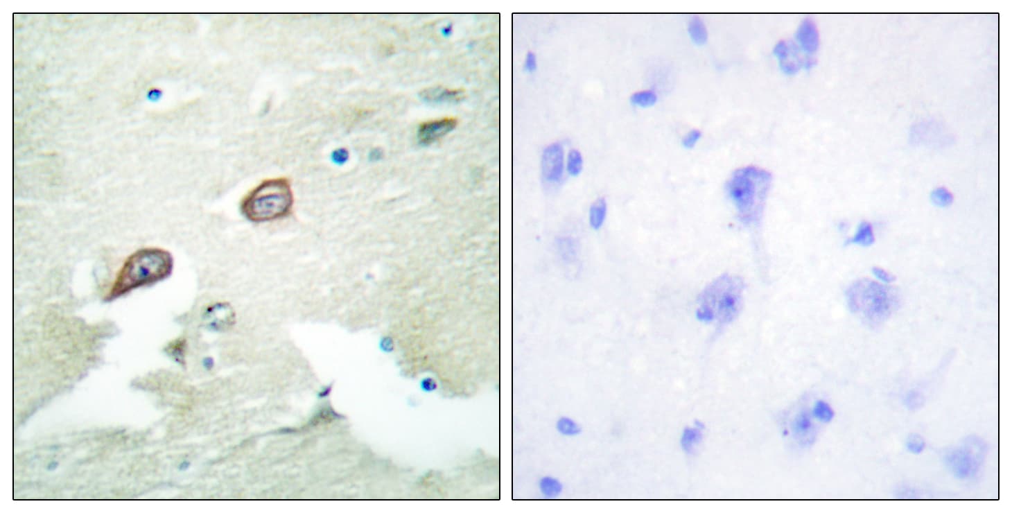 ERBB3 / HER3 Antibody (aa1191-1240)
