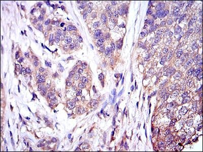 Monoclonal Mouse anti-Human MAPK3 / ERK1 Antibody (clone 100000, IHC, IF, WB)