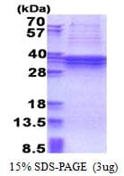 Human TBC1 / TBC1D1 Protein (Recombinant His)