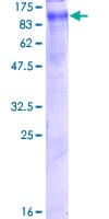 Human ClC-5 / CLCN5 Protein (Recombinant GST)