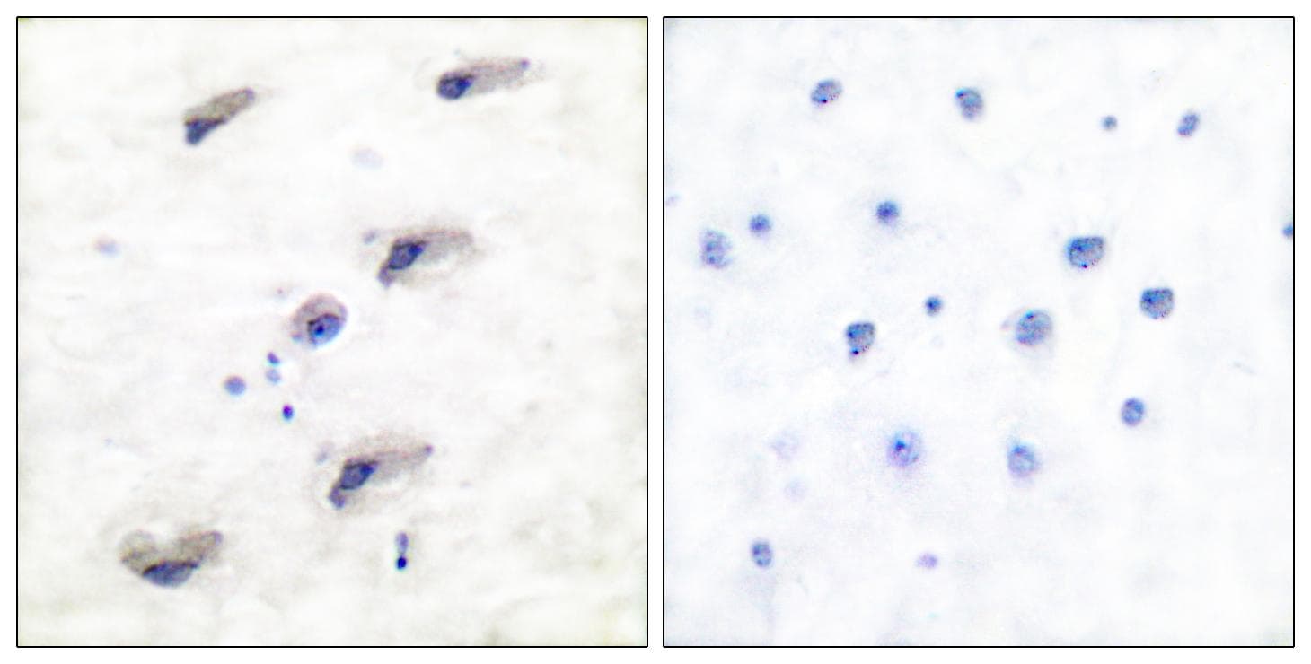 MTOR Antibody (p2448)