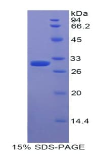 Human MYO1E / Myosin IE Protein (Recombinant His)