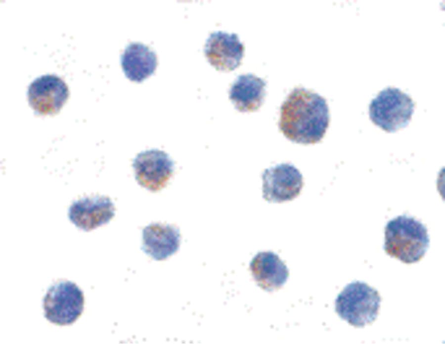 CHUK / IKKA / IKK Alpha Antibody
