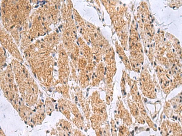 SLC4A3 / AE3 Antibody