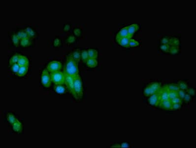 EIF5 Antibody (aa1-431)