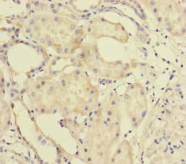 Polyclonal Rabbit anti-Human MTO1 Antibody (IHC, WB)