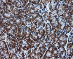 TPMT Antibody (clone OTI2A2)